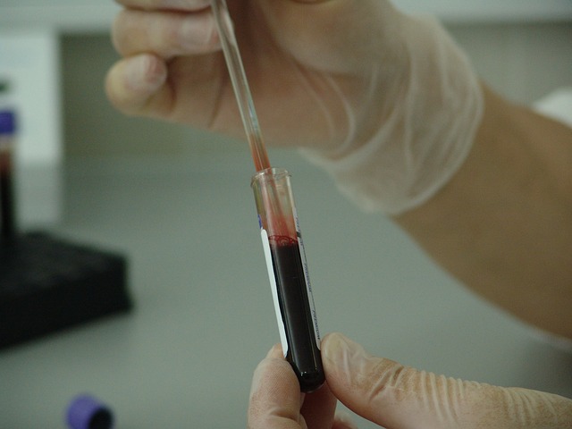 hiv virus